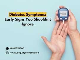  Diabetes Symptoms: Signs You Shouldn't Ignore, New Delhi