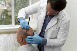  Expert Hair Transplant Services in Lucknow , Lucknow