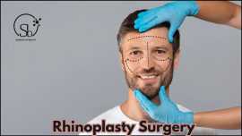 Rhinoplasty Surgery In Hyderabad, Hyderabad