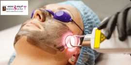 Advanced Melasma Treatment in Bangalore at Dermaqu, Bengaluru