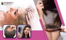 Best Hair Loss Treatment in Bangalore - Dermaqure, Bengaluru