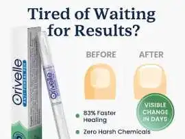 Orivelle Fungus Pen Netherlands Reviews (2026) , New Hartford