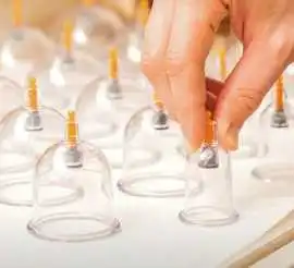 Hijama Therapy in Dubai for Natural Healing, Dubai