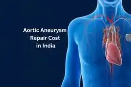 Aortic Aneurysm Repair Cost in India – HOSPIDIO, Noida