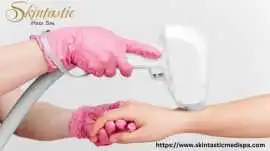 Best Laser Hair Removal in Riverside for Hair-Free, Riverside