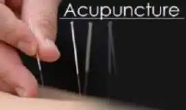 Acupuncture for Neck Pain in Morristown Drug-Free, Morristown