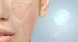 Acne Treatment in Dubai: Clear, Healthy Skin, Dubai