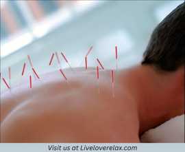 Unlock Healing with Best Acupuncture in Austin, Austin