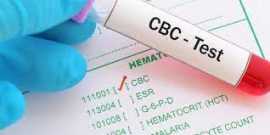 Comprehensive CBC EDTA Blood Test - ManipalTRUtest, Indore