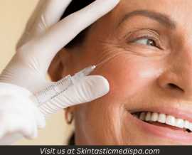 Experience the Magic with Botox in Riverside, Riverside