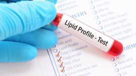 Lipid Profile Test at Home - Manipal TRUtest, Indore