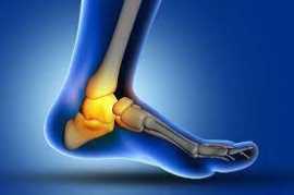 6 Ankle Ligament Tear Pain Remedies, Novena