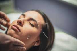 Find the Top Acupuncture Treatment Options London , London