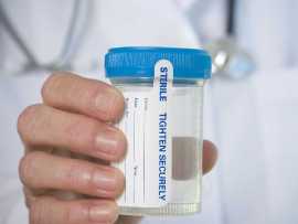 Choose The Best THC testing kits in USA, Medford