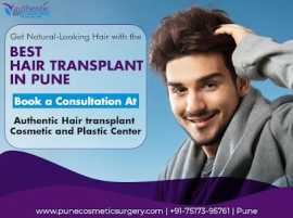 Looking for a Premium Hair Transplant Clinic, Pune, Pune