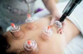 Trusted Chinese Cupping Therapy Experts, Melbourne