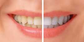 Trusted Dental Care in North London, London