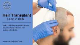 Hair Transplant Clinic In Delhi | DMC Trichology, New Delhi
