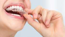 Dentiste Côte-des-Neiges : Des soins de qualité, Montreal