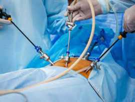 Laparoscopic Surgeon in Jaipur, Jaipur