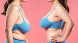 Are You a Good Candidate for Breast Implants in Ca, San Francisco