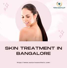 Best Skin Treatment in Bangalore – East Arise Aest, Bengaluru