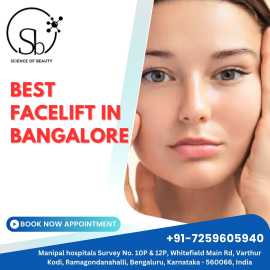 Best Facelift Surgery in Bangalore
