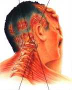Headaches & Migraines Diagnosis Services, Orlando
