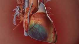 Total arterial beating heart Surgery in Jaipur, Jaipur