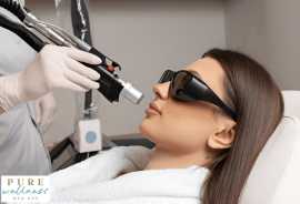 Transform Your Skin with Laser Hair Removal, Ocala