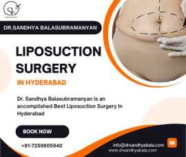 Expert Liposuction Surgery in Hyderabad, Hyderabad