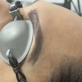 Find Cheap Laser Tattoo Removal in McKinney , McKinney