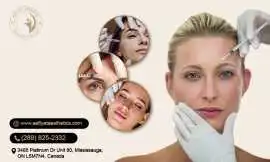 Best Botox Clinic Mississauga – Aafiyat Advanced A, Mississauga