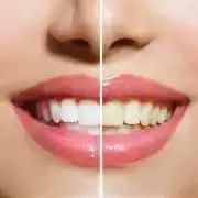 Cosmetic Orthodontics & Invisible Braces | Con, Bromley