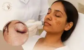 Top Laser Treatment Services – Aafiyat Advanced Ae, Mississauga