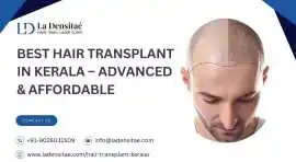 Best Hair Transplant in Kerala – Advanced & Afford, Ernakulam