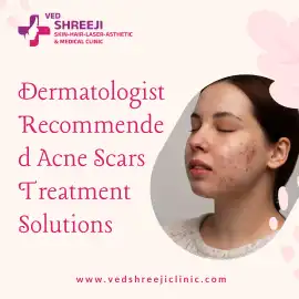 Dermatologist Recommended Acne Scars Treatment , Ahmedabad