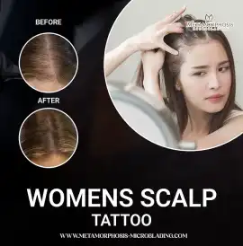 Womens scalp tattoo: Gain Confidence & Hair Restor, Vancouver