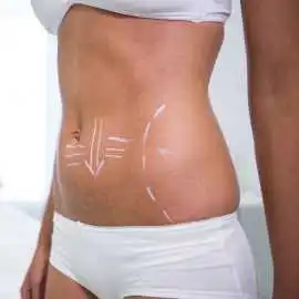 Best Body Sculpting Surgery in San Francisco, San Francisco