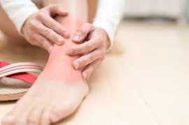 6 Easy Sprained Ankle Treatment, Novena