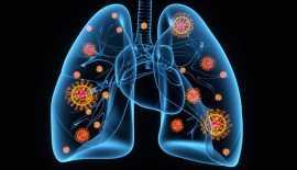 Enhancing Lung Capacity Naturally, Jaipur