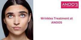 Advanced Wrinkles Treatment at Anoos, Hyderabad