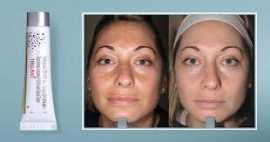 Tri luma Cream Buy - Get Instant Result Skin Dark , Buffalo