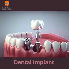 Unmatched Dental Excellence by Dr. Vasundhara., Noida