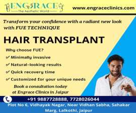 FUE Hair Transplant at Engrace Clinics Jaipur, Jaipur