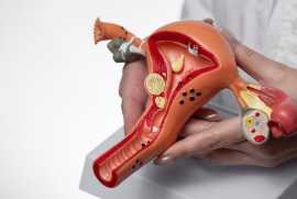 Treatment for Gynecologic Cancer in Ahmedabad, Ahmedabad