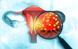 Trusted Uterine Cancer Specialist in Ahmedabad, Ahmedabad
