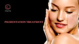 Pigmentation Treatment in Bangalore, Bengaluru