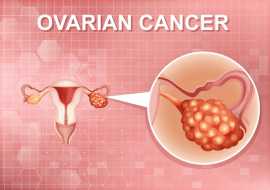 Consult the best Ovarian Cancer Surgeon Ahmedabad, Ahmedabad