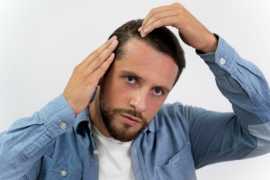 Hair Transplant Brisbane, Brisbane